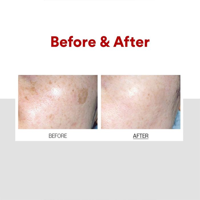 کرم ضد لک و روشن کننده ملانون ایکس مدی پیل MEDI-PEEL Melanon X Cream