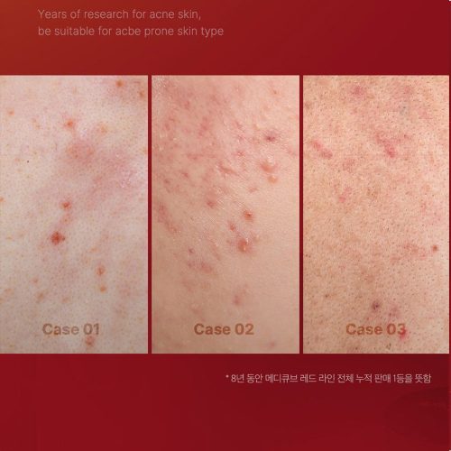 تونر ضد جوش و تسکین دهنده مدی کیوب Medicube Red Toner