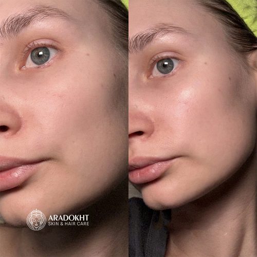 تونر کرمی بریر سلیمکس ترمیم و تقویت کننده سد دفاعی پوست Celimax Dual Barrier Creamy Toner