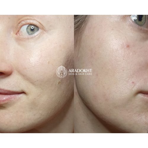 تونر کرمی بریر سلیمکس ترمیم و تقویت کننده سد دفاعی پوست Celimax Dual Barrier Creamy Toner