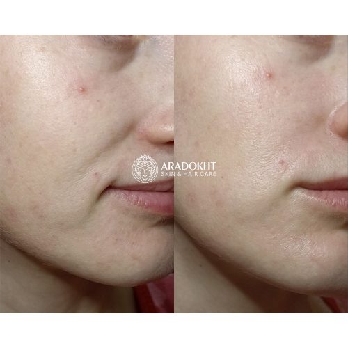 تونر کرمی بریر سلیمکس ترمیم و تقویت کننده سد دفاعی پوست Celimax Dual Barrier Creamy Toner