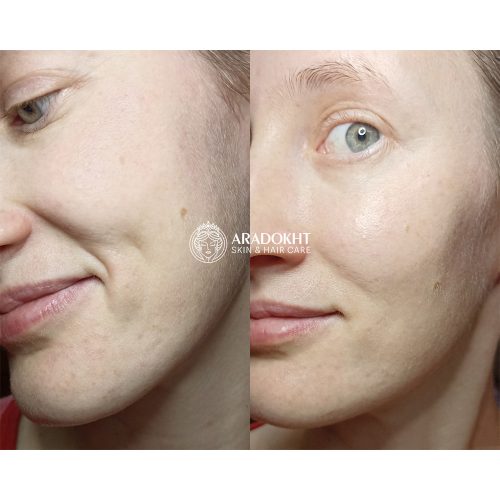 تونر کرمی بریر سلیمکس ترمیم و تقویت کننده سد دفاعی پوست Celimax Dual Barrier Creamy Toner