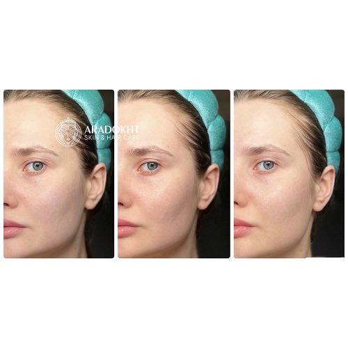 تونر کرمی بریر سلیمکس ترمیم و تقویت کننده سد دفاعی پوست Celimax Dual Barrier Creamy Toner