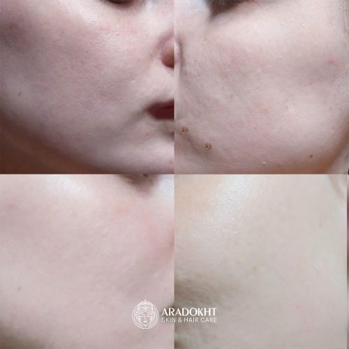 تونر کرمی بریر سلیمکس ترمیم و تقویت کننده سد دفاعی پوست Celimax Dual Barrier Creamy Toner