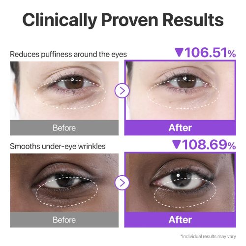 پچ زیر چشم +NAD و کلاژن شماره 9 نامبوزین ضد چروک، ضد پف و تیرگی Numbuzin No.9 NAD+ Collagen Under Eye
