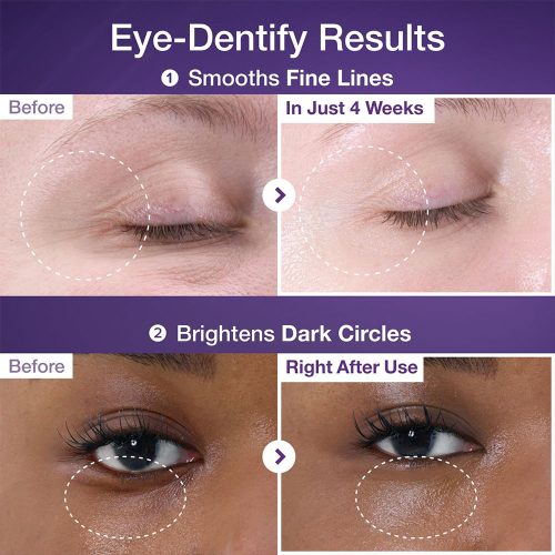 کرم دور چشم +NAD و رتینول شماره 9 نامبوزین ضد چروک و روشن کننده NUMBUZIN No.9 NAD+ Retinol Volumetox Eye Cream
