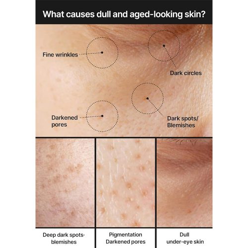 کرم ضد لک و کنترل منافذ سلیمکس روشن کننده پوست Celimax Pore+Dark Spot Brightening Cream