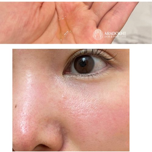 تونر لایه بردار و روشن کننده کوجیک اسید و زردچوبه مدی کیوب MEDICUBE Kojic Acid Turmeric Resurfacing Toner