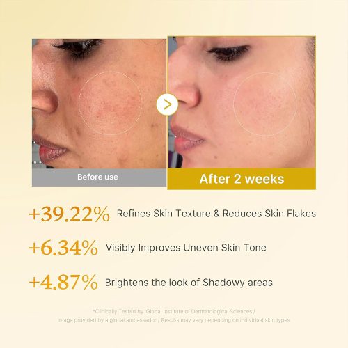 تونر لایه بردار و روشن کننده کوجیک اسید و زردچوبه مدی کیوب MEDICUBE Kojic Acid Turmeric Resurfacing Toner