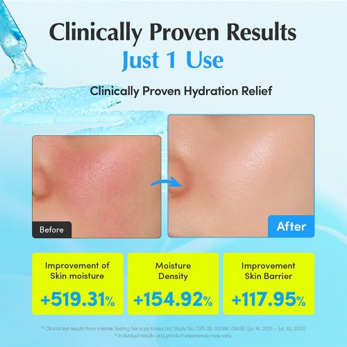 سرم آبرسان و تسکین دهنده هیالتوئین اکوال بری EQQUALBERRY Hyaltoin Flooding Serum