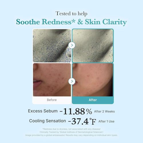 تونر آزلائیک اسید و نیاسینامید مدی کیوب ضدالتهاب، قرمزی و روشن کننده پوست MEDICUBE Azelaic Acid Niacinamide Clear Toner