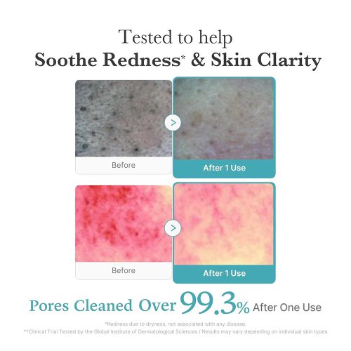 فوم شوینده آزلائیک اسید و نیاسینامید آنوا روشن کننده و تسکین دهنده پوست Medicube Azelaic Acid Niacinamide Deep Clean Foam Cleanser