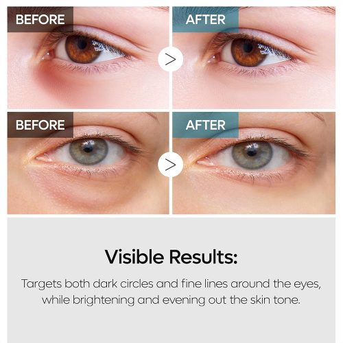کرم دور چشم ترانگزامیک اسید و رتینال دکتر ملاکسین ضد چروک و روشن کننده قوی Dr.Melaxin TX Retinalsome Double Effect Eye Cream