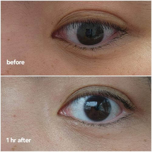 کرم دور چشم ترانگزامیک اسید و رتینال دکتر ملاکسین ضد چروک و روشن کننده قوی Dr.Melaxin TX Retinalsome Double Effect Eye Cream