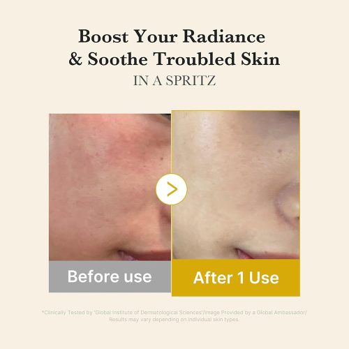 میست سرم ژلی کوجیک اسید و زردچوبه مدی کیوب روشن کننده و تسکین دهنده پوست Medicube Kojic Acid Turmeric Vita Jelly Mist Serum