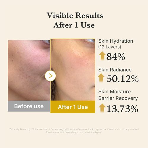 میست سرم ژلی کوجیک اسید و زردچوبه مدی کیوب روشن کننده و تسکین دهنده پوست Medicube Kojic Acid Turmeric Vita Jelly Mist Serum
