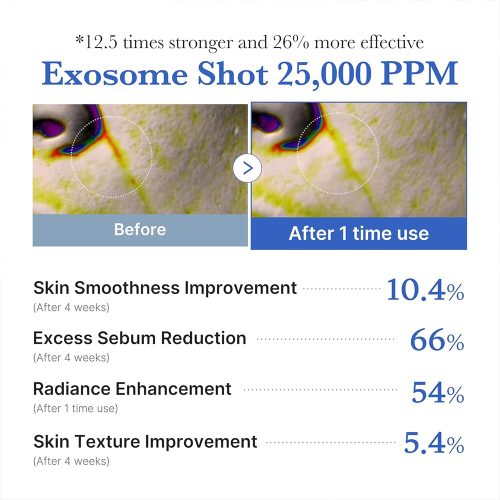 آمپول کنترل منافذ اگزوزوم شات 25000 مدی کیوب لایه بردار، ضد جوش و روشن کننده Medicube One Day Exosome Shot Pore Ampoule 25000