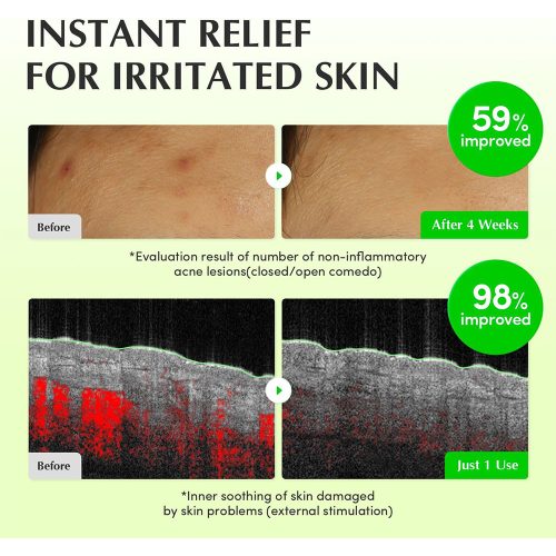 تونر PDRN آلوئه ورا اکوال بری تسکین دهنده و ترمیم کننده پوست EQQUALBERRY Aloe PDRN Calming Toner