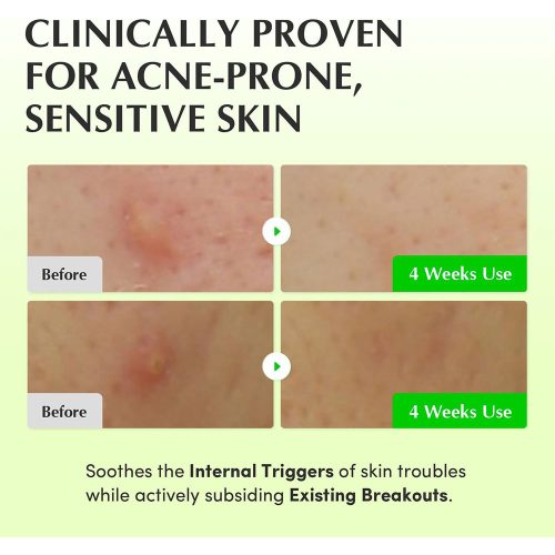 تونر PDRN آلوئه ورا اکوال بری تسکین دهنده و ترمیم کننده پوست EQQUALBERRY Aloe PDRN Calming Toner