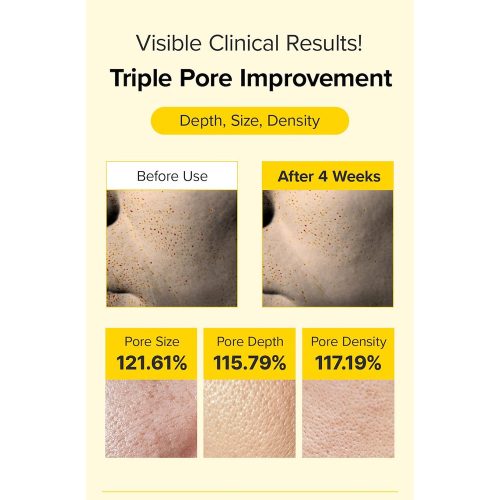 کرم اسپیکول رتینول و PDRN مری اند می ضد چروک و جوانساز پوست Mary & May Spicule Retinol PDRN Cream