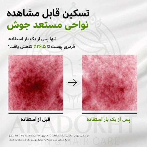 لوسیون مرطوب کننده آزلائیک اسید و سیکا آنوا تسکین دهنده، ضد جوش و ضد التهاب Anua Azelaic Acid Cica Skin Soothing Moisturizer