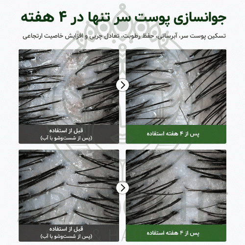 آمپول PDRN مو ریدل شات 100 وی تی کازمتیک احیا، ضد ریزش و تقویت مو VT Cosmetics PDRN Reedle Shot Hair Ampoule 100dL