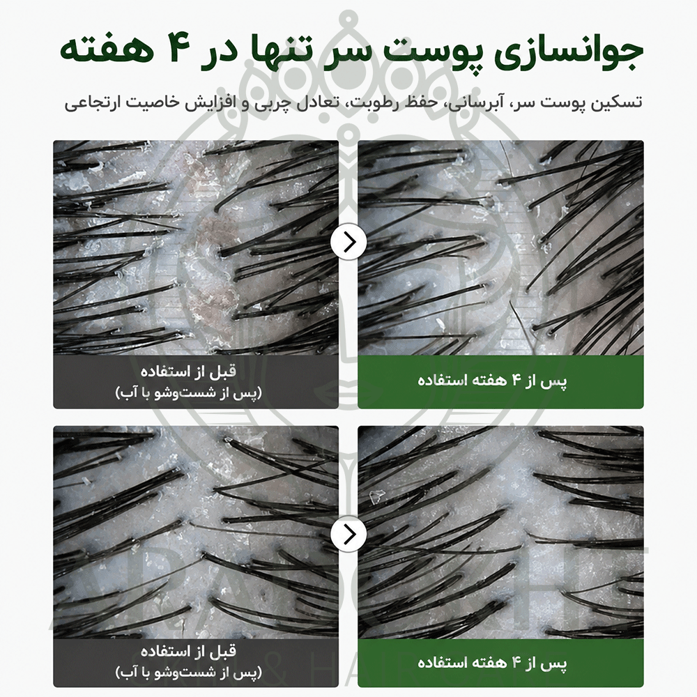 آمپول PDRN مو ریدل شات 100 وی تی کازمتیک احیا، ضد ریزش و تقویت مو VT Cosmetics PDRN Reedle Shot Hair Ampoule 100dL