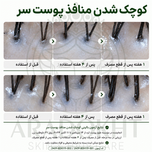 آمپول PDRN مو ریدل شات 100 وی تی کازمتیک احیا، ضد ریزش و تقویت مو VT Cosmetics PDRN Reedle Shot Hair Ampoule 100dL