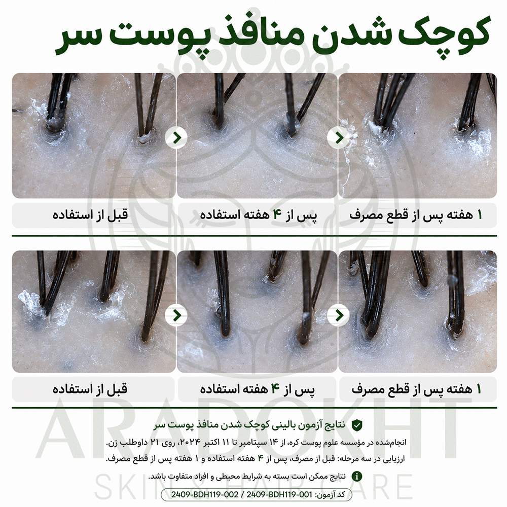 آمپول PDRN مو ریدل شات 100 وی تی کازمتیک احیا، ضد ریزش و تقویت مو VT Cosmetics PDRN Reedle Shot Hair Ampoule 100dL