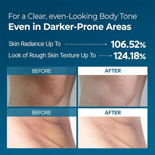 اسپری پیل شات بدن ترانگزامیک اسید دکتر ملاکسین روشن کننده و لایه بردار ملایم Dr.Melaxin Peel Shot Exfoliating TX-Spray