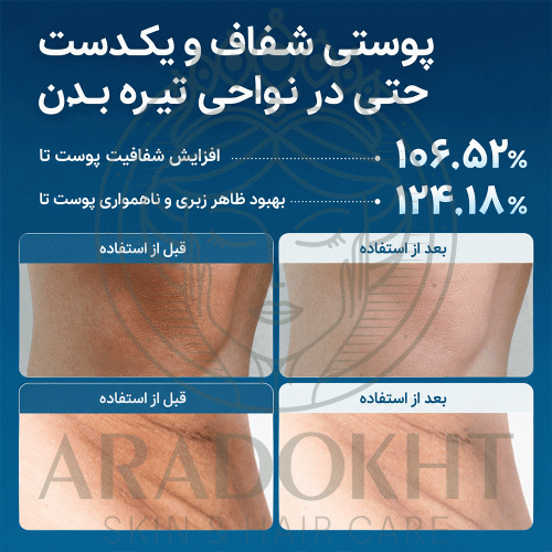اسپری پیل شات بدن ترانگزامیک اسید دکتر ملاکسین روشن کننده و لایه بردار ملایم Dr.Melaxin Peel Shot Exfoliating TX-Spray