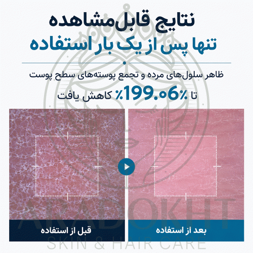 اسپری پیل شات بدن ترانگزامیک اسید دکتر ملاکسین روشن کننده و لایه بردار ملایم Dr.Melaxin Peel Shot Exfoliating TX-Spray