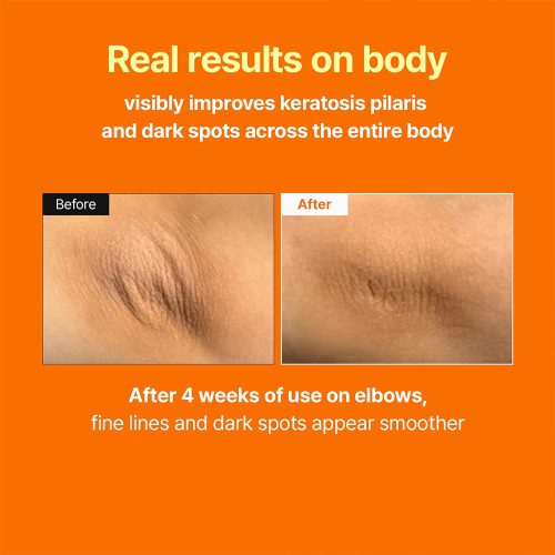 بوستر سرم رتینال مدی تراپی ضد چروک، روشن کننده و جوانساز پوست MEDITHERAPY Retinal Skin Booster Serum