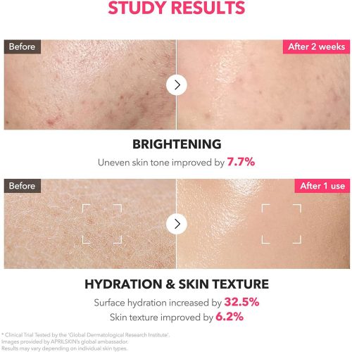 تونر شیری ترانگزامیک اسید و نیاسینامید آپریل اسکین ضد لک و روشن کننده قوی پوست APRILSKIN TXA Niacinamide 99 Milky Toner