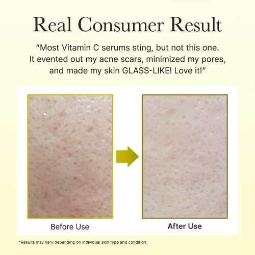 سرم دور چشم و صورت ویتامین سی بوستر شات آرنسیا روشن کننده و مرطوب کننده پوست Arencia Vitamin C Booster Shot