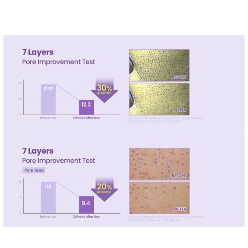 سرم نیاسینامید 20 درصد تیر تیر روشن کننده، کنترل چربی و منافذ پوست TIRTIR Niacinamide 20% Serum