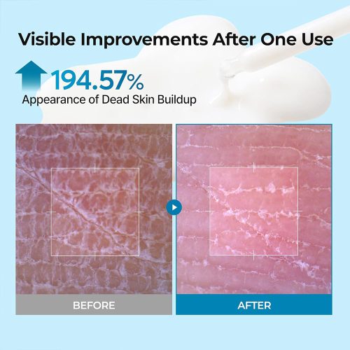 سرم پیل شات ترانگزامیک اسید دکتر ملاکسین روشن کننده و لایه بردار ملایم پوست Dr.Melaxin Peel Shot Exfoliating TX-Serum