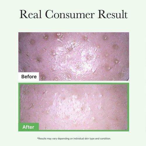 شوینده روغنی کنترل منافذ موچی آرنسیا Arencia Pore Melt Mochi Cleansing Oil