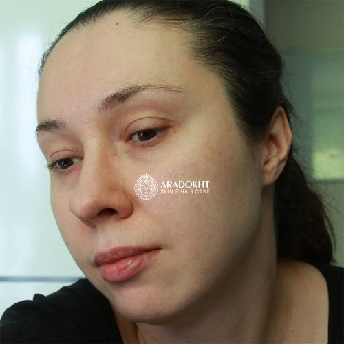 ماسک و اسکراب خاک رس و پپتاید دبی دکتر ملاکسین لایه بردار ملایم، کنترل منافد و روشن کننده پوست Dr.Melaxin Dubai Peptide Clay Mask