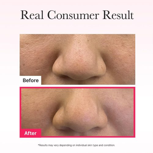 ماسک ژلی کلاژن قرمز آرنسیا آبرسان، ضد چروک و تقویت سد دفاعی پوست Arencia Red Collagen Jello Mask Set