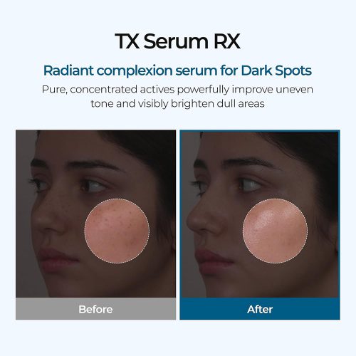 سرم ترانگزامیک اسید دکتر ملاکسین ضدلک و روشن کننده و تقویت سد دفاعی پوست Dr.melaxin TX ampoule RX