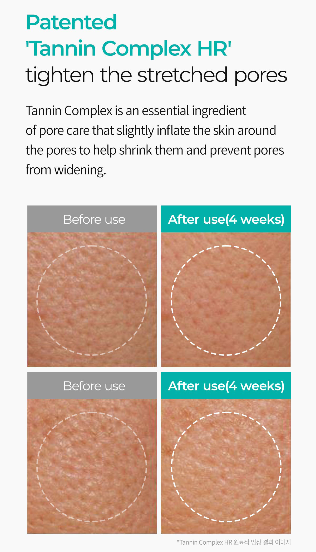 ماسک ورقه ای کنترل منافذ دکتر ملاکسین Dr.Melaxin BP Pore Clear Masks
