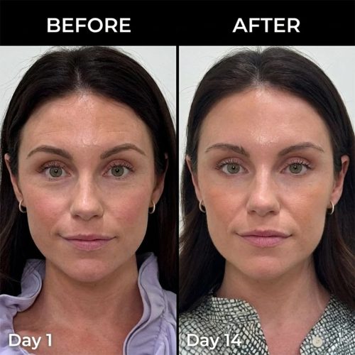 مولتی بالم PDRN و کلاژن مدی کیوب ضد چروک، ترمیم کننده و لیفت کننده پوست Medicube PDRN Pink Collagen Volume Multi Balm