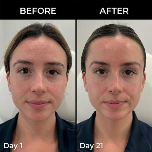 مولتی بالم PDRN و کلاژن مدی کیوب ضد چروک، ترمیم کننده و لیفت کننده پوست Medicube PDRN Pink Collagen Volume Multi Balm
