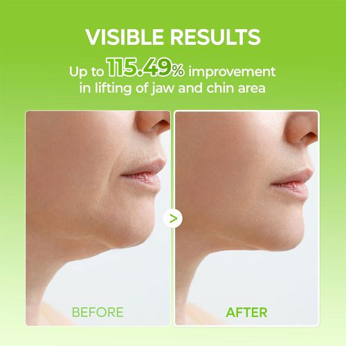 پک ماسک لیفت و خنک کننده فک و غبغب دکتر ملاکسین Dr.Melaxin Cactox Cooling V-UP Mask Set