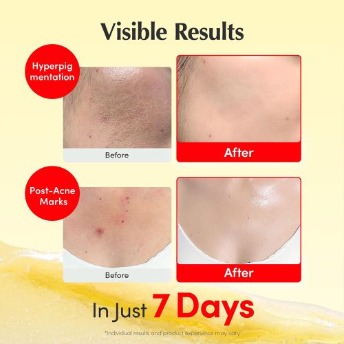 کرم کپسولی ویتامینه اکوال بری ضد لک قوی، روشن کننده و تقویت سد دفاعی پوست EQQUALBERRY Vitamin Illuminating Cream