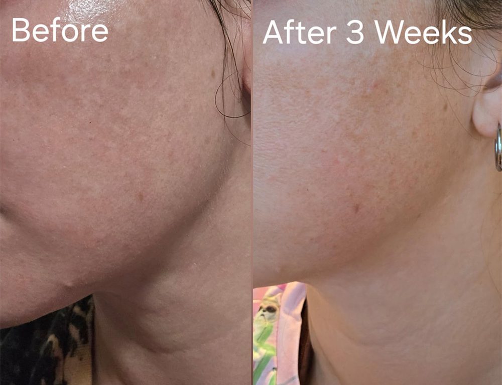 گواشا کرم رتینول و کلاژن آنوا ضد چروک، جوانساز و فرم دهنده Anua Collagen Retinol Refining Gua Sha Cream