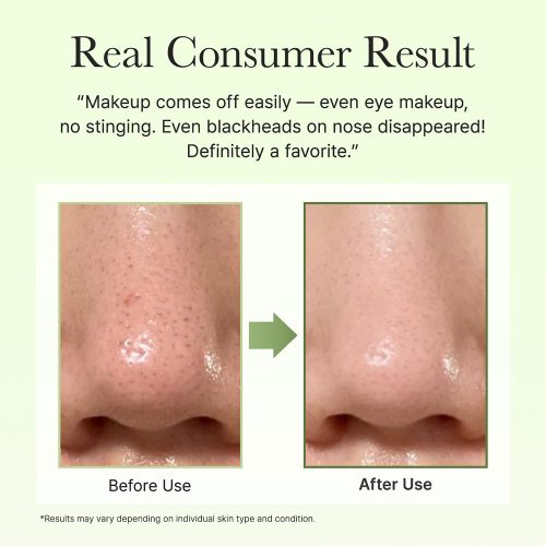 بالم پاک کننده عمقی منافذ و ضد جوش فیتو PDRN آرنسیا ARENCIA Pore Melt Phyto PDRN Cleansing Balm