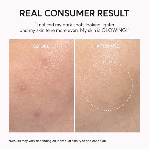 بوستر شات ترانگزامیک اسید آرنسیا ضد لک و روشن کننده قوی پوست Arencia TXA Booster Shot Serum