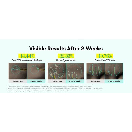 دور چشم ویبره دار PDRN وی تی کازمتیک آبرسان، ترمیم کننده، روشن کننده و جوانساز پوست VT Cosmetics PDRN Reedle Shot Eye Lifter